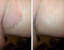 Savon Purifiant Antifongique